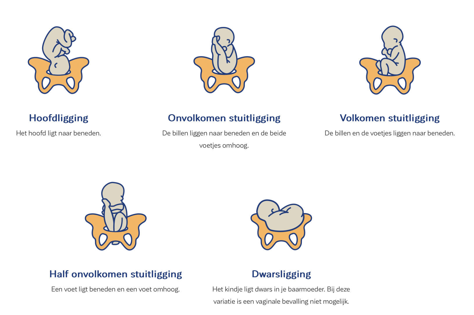 Afbeelding met daarop verschillende houdingen waarop een baby in het bekken kan liggen.